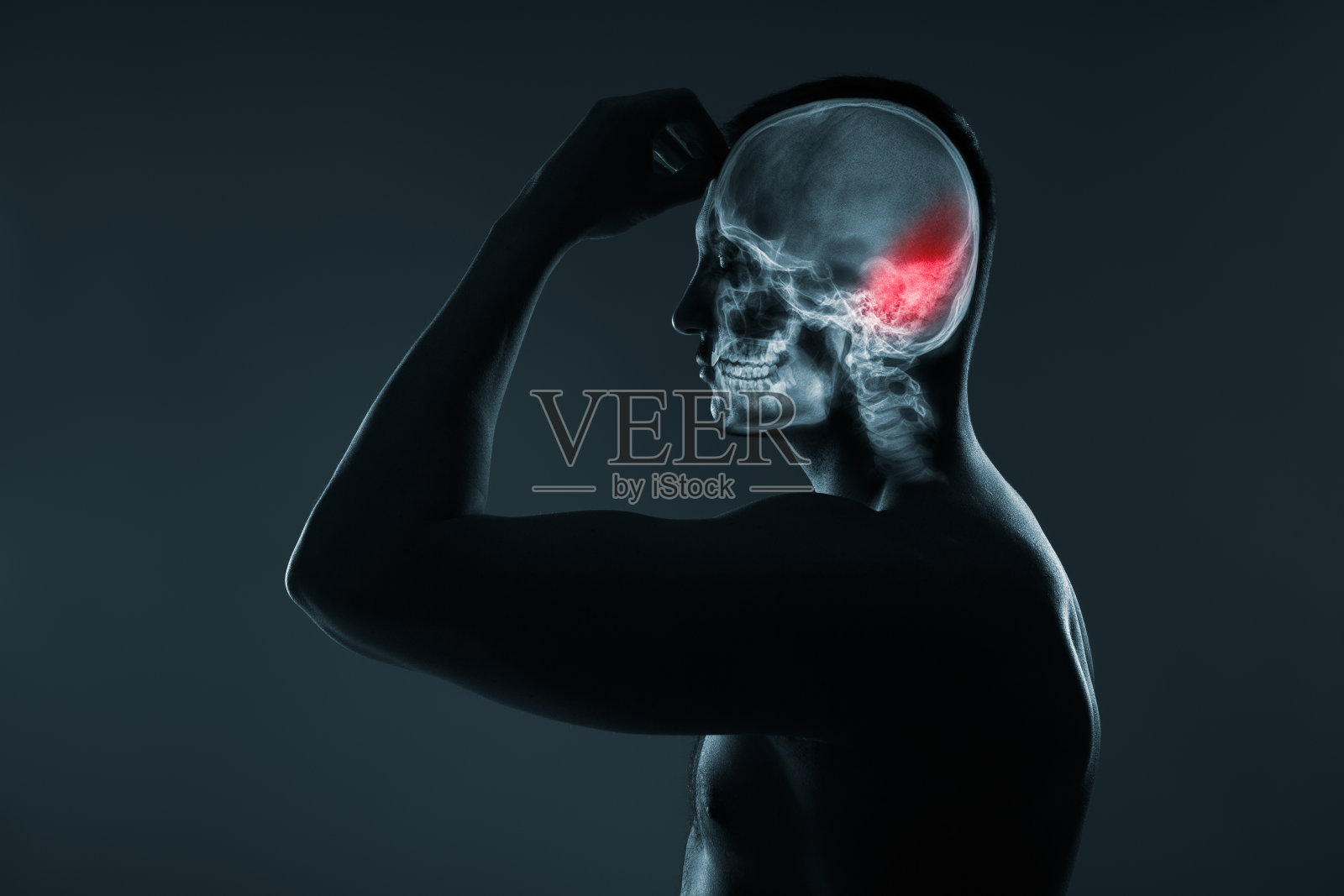 人头部X光片：脑卒中，红色高亮显示脑损伤照片摄影图片