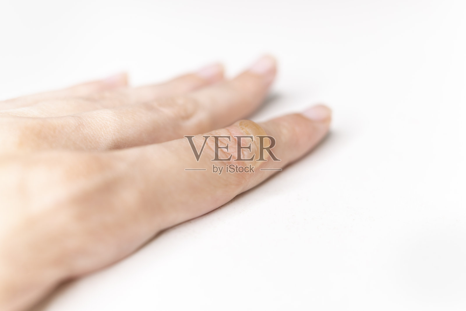 女人的手上有一个烧伤的水泡。手指烧伤。一个水照片摄影图片