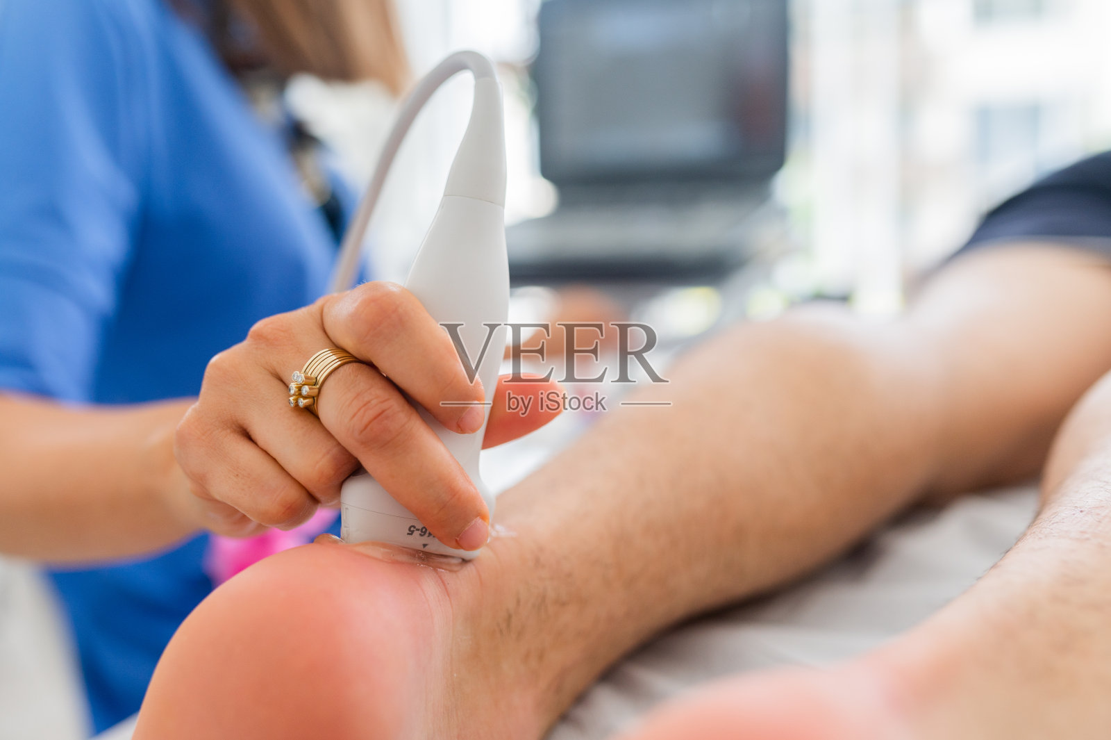 给跟腱做超声波扫描照片摄影图片