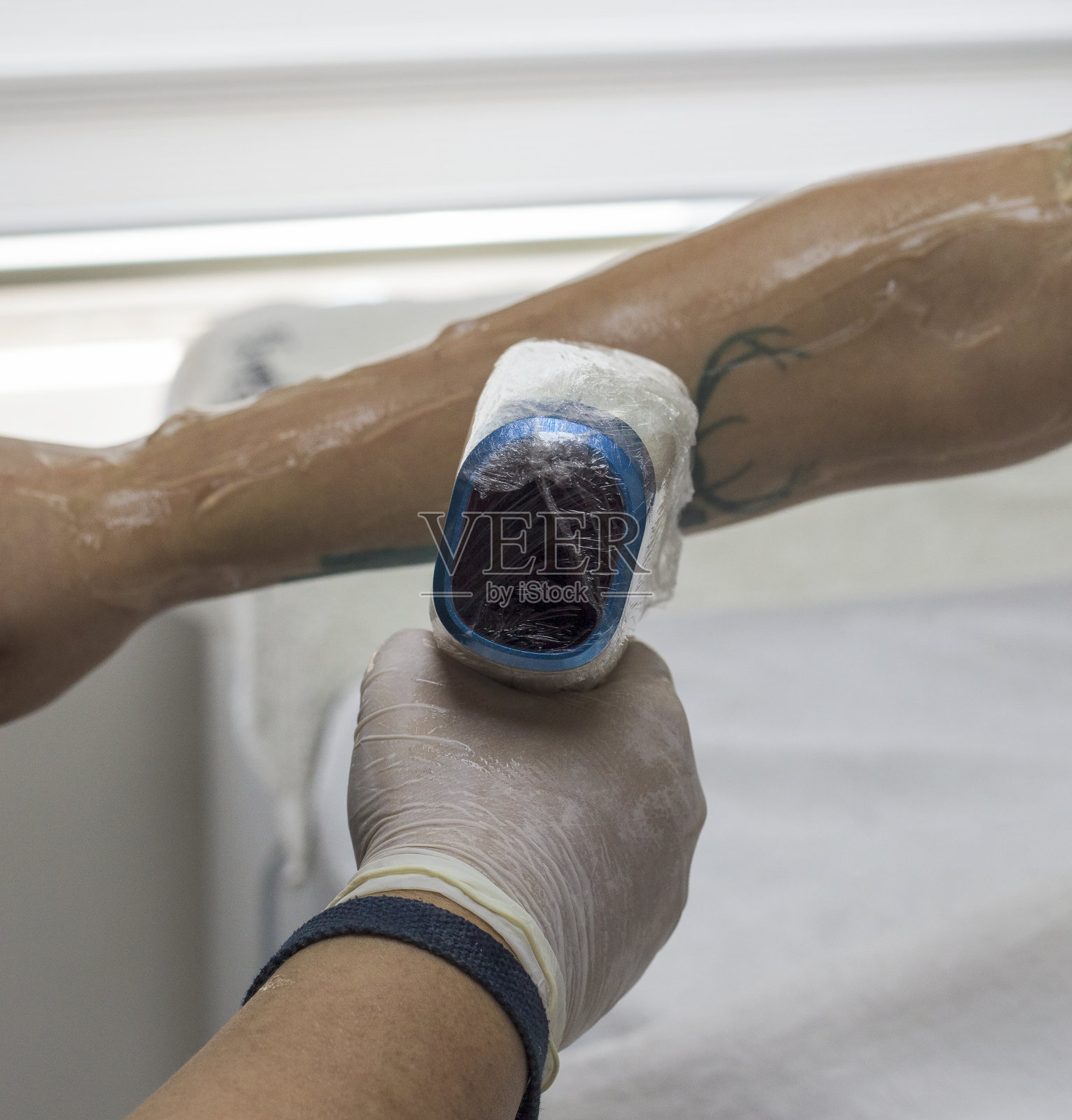 美容院激光脱毛照片摄影图片