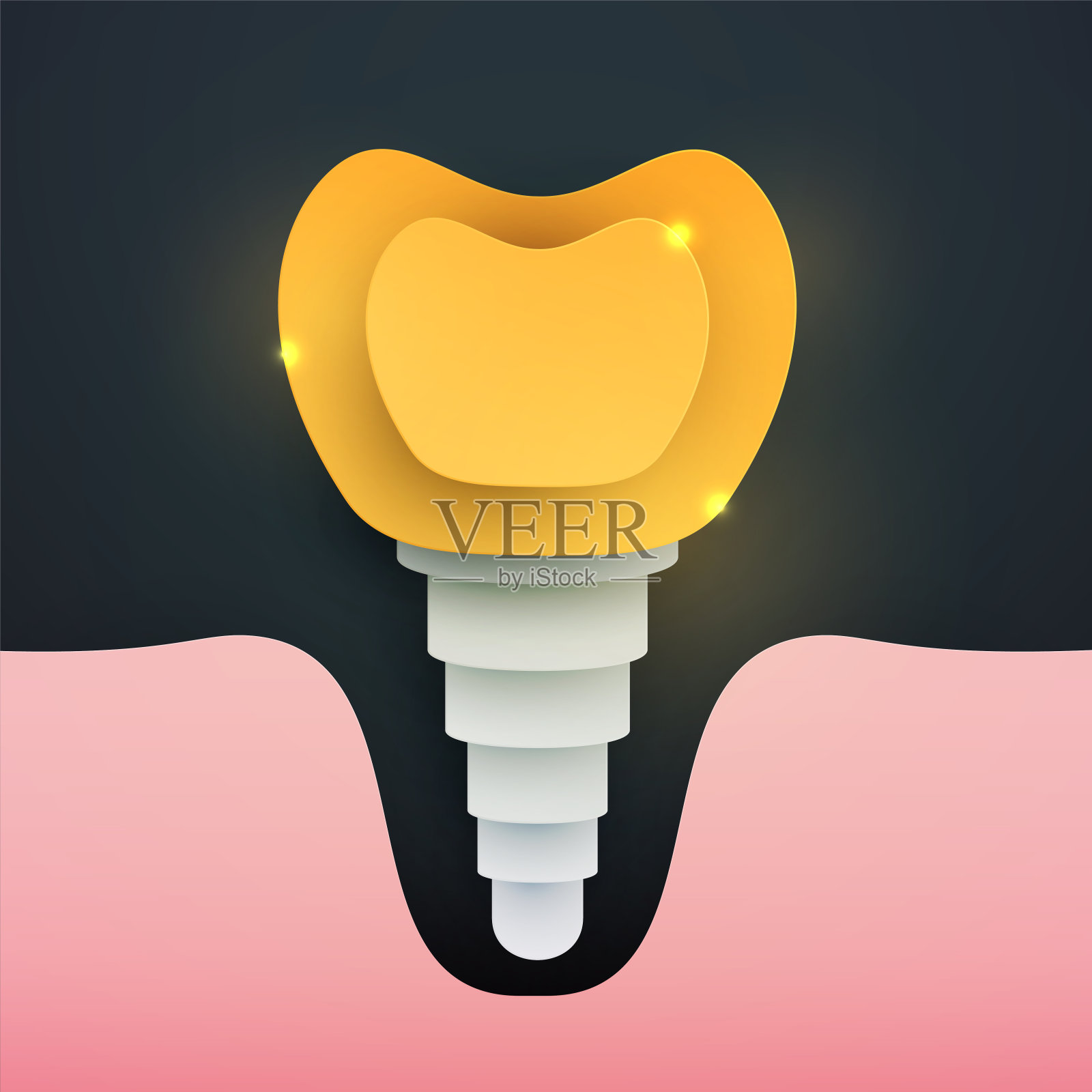 人类金牙植入剪影，现代创意风格。奢华简约的设计理念。优质医疗保健医疗构成艺术元素。明亮的剪纸层矢量插图。设计模板素材