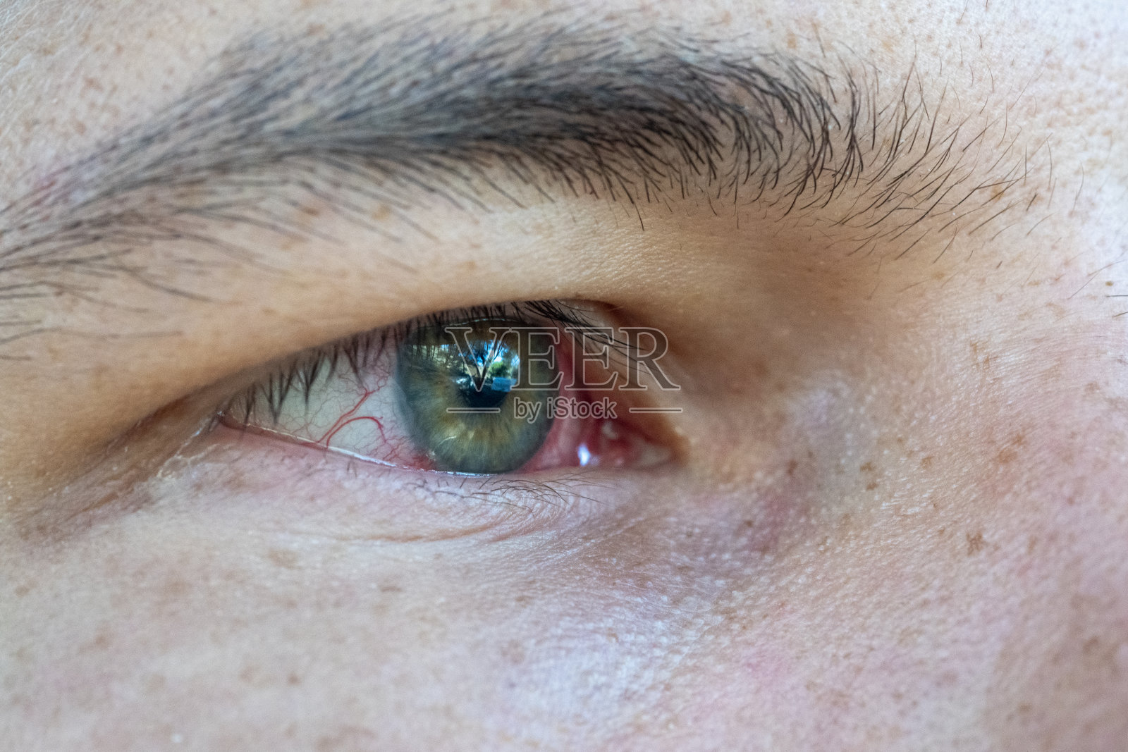 绿眼男士使用隐形眼镜后眼睛过敏的微距照片。库存图片照片摄影图片