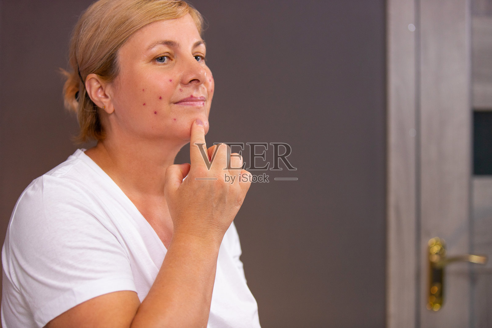 照片中，一个金发女人穿着白色t恤，脸上有痤疮，食指放在下巴上。照片摄影图片