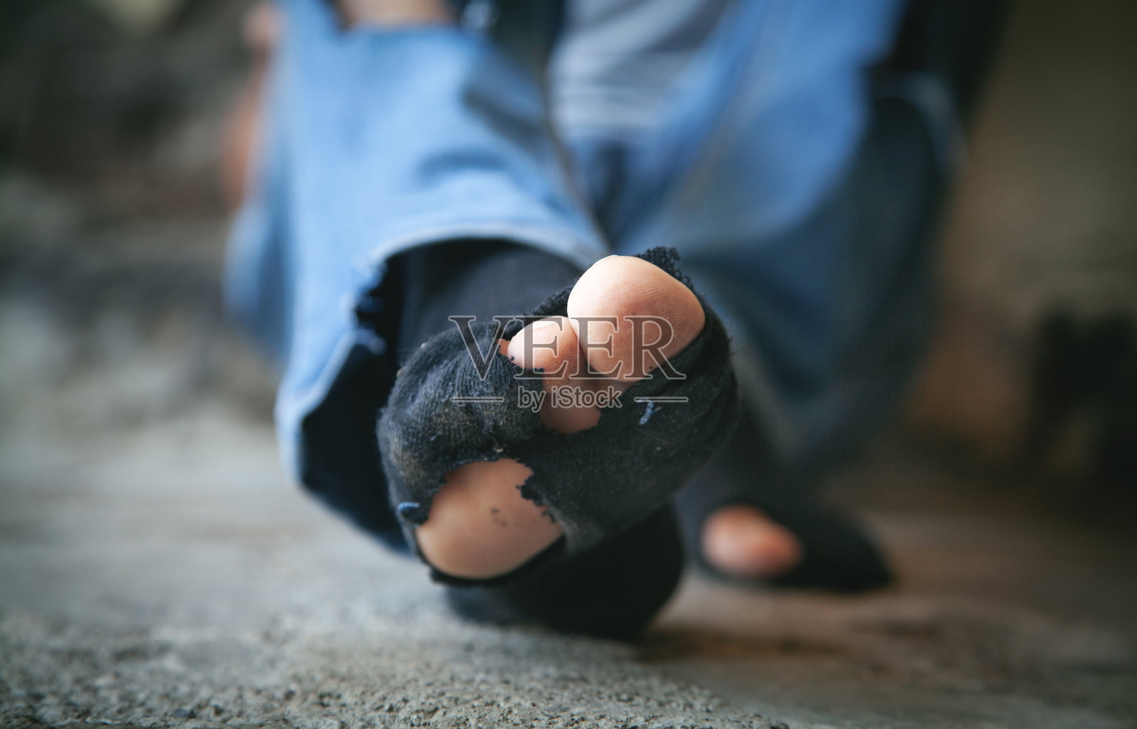 一个白人流浪汉可怜的脚。照片摄影图片