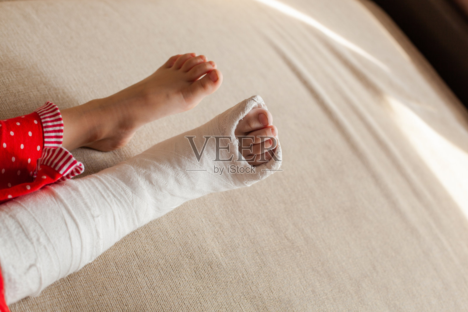 家里的沙发上躺着一个打了石膏的女孩，她受伤的腿已经面目全非照片摄影图片