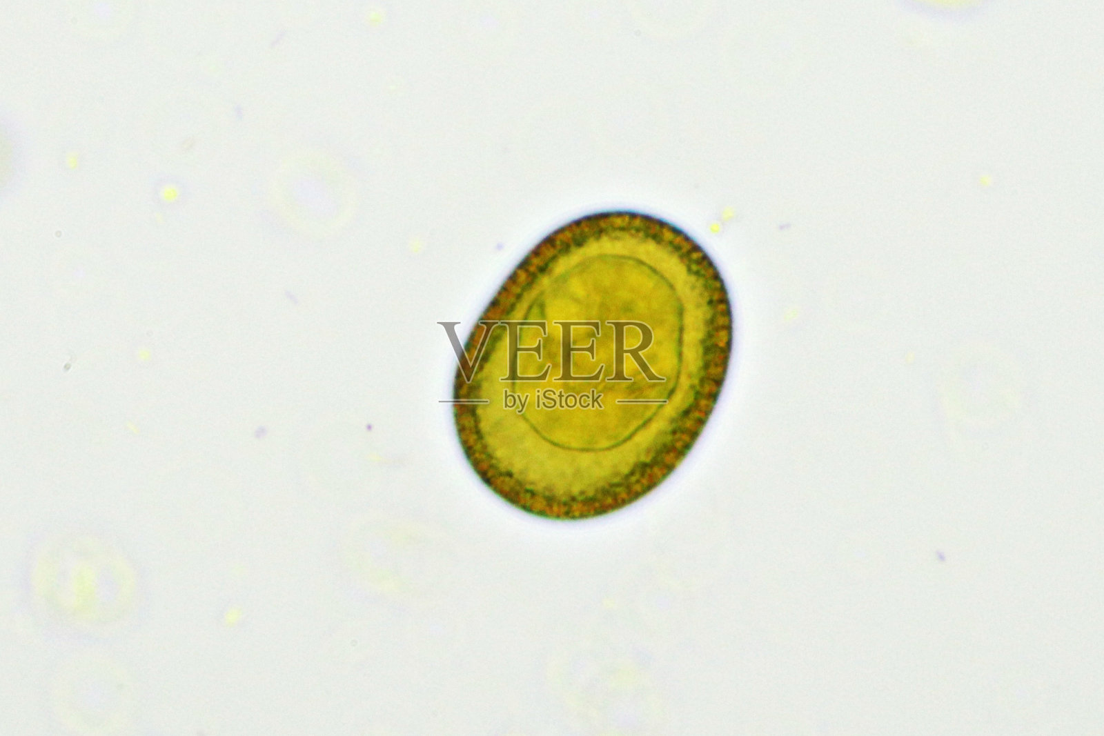 人粪便中有带绦虫或绦虫卵照片摄影图片