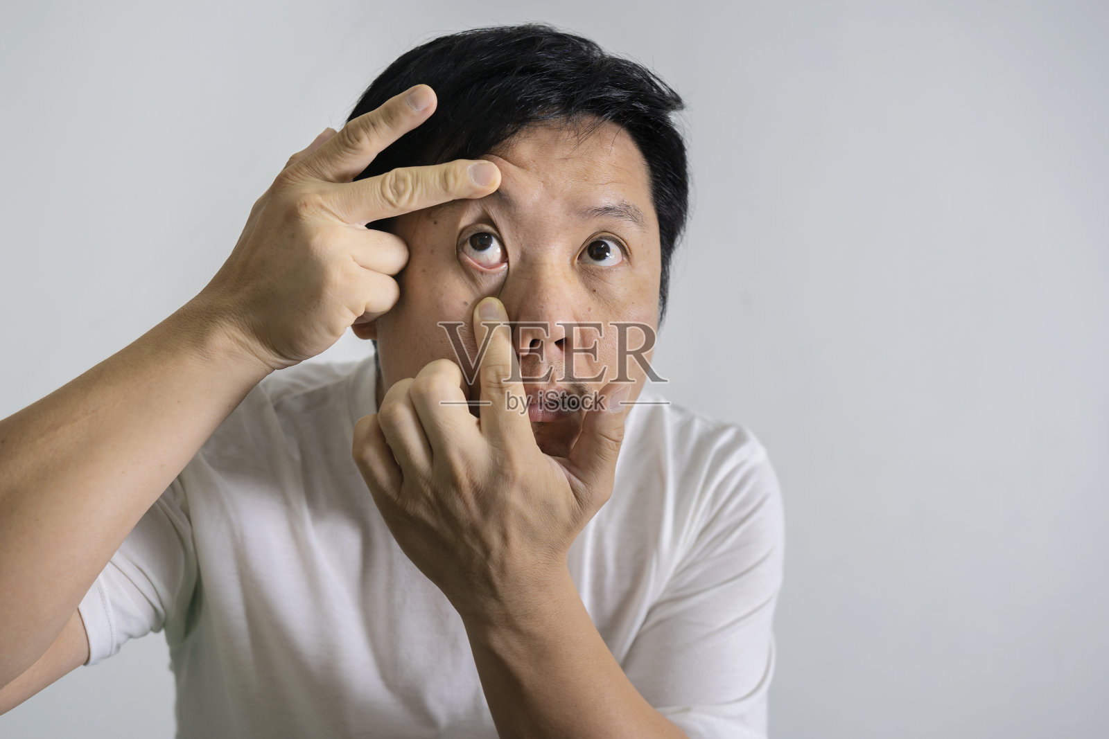 眼睛刺激性的概念。亚洲男人的肖像在姿势的眼睛疲劳照片摄影图片