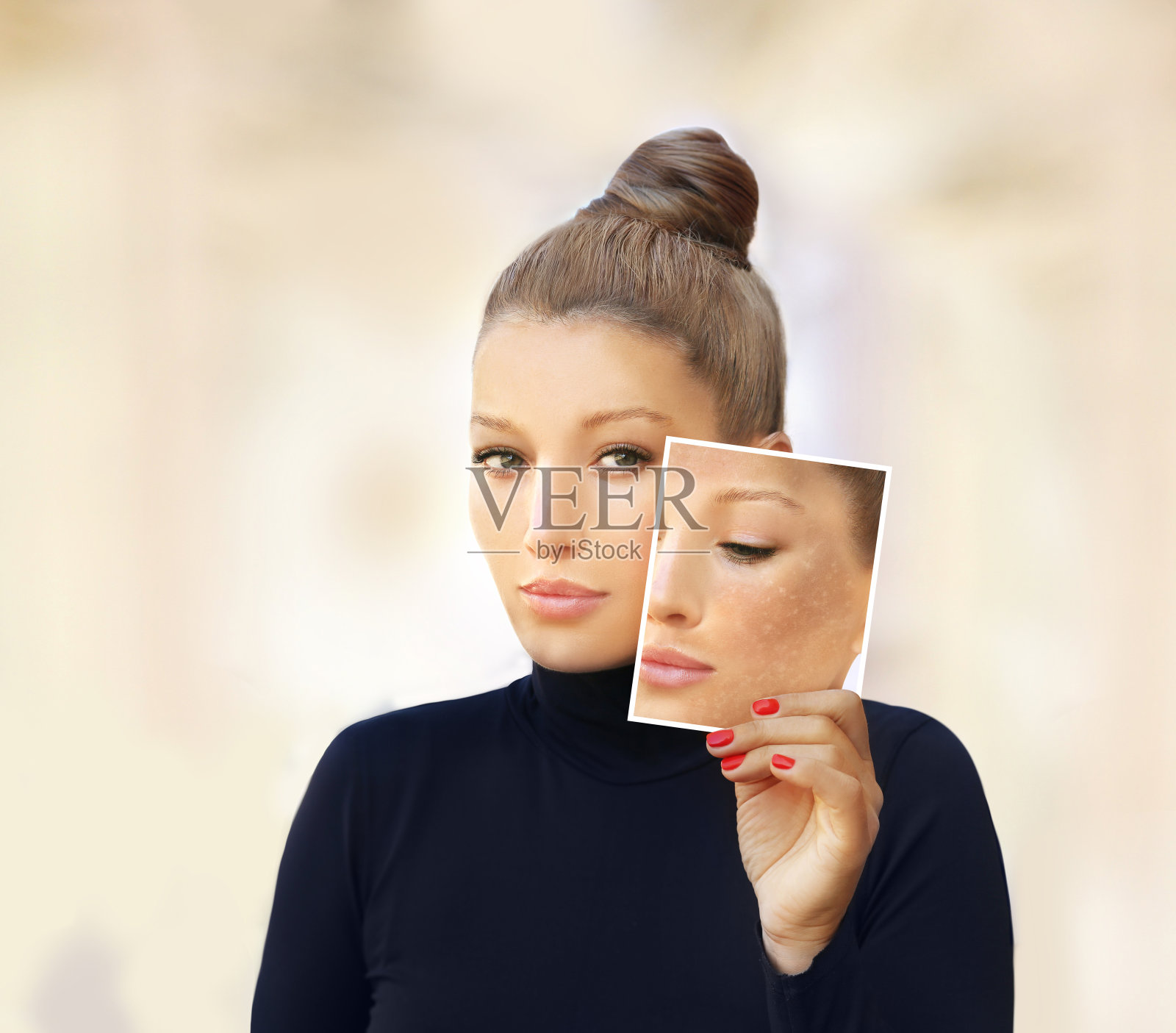 黑斑，雀斑，色素沉着(黄褐斑或黄褐斑)，概念-皮肤美白，皮肤美白，果酸，AHA，皮肤亮白。照片摄影图片