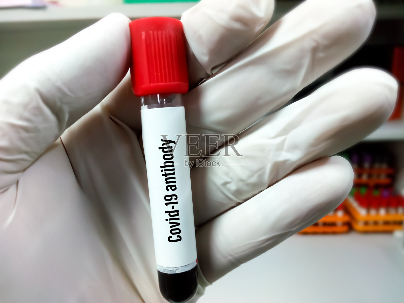 冠状病毒感染的抗体检测。检查人群是否对covid - 19免疫。有实验室背景的科学家手中拿着血液测试的试管照片摄影图片