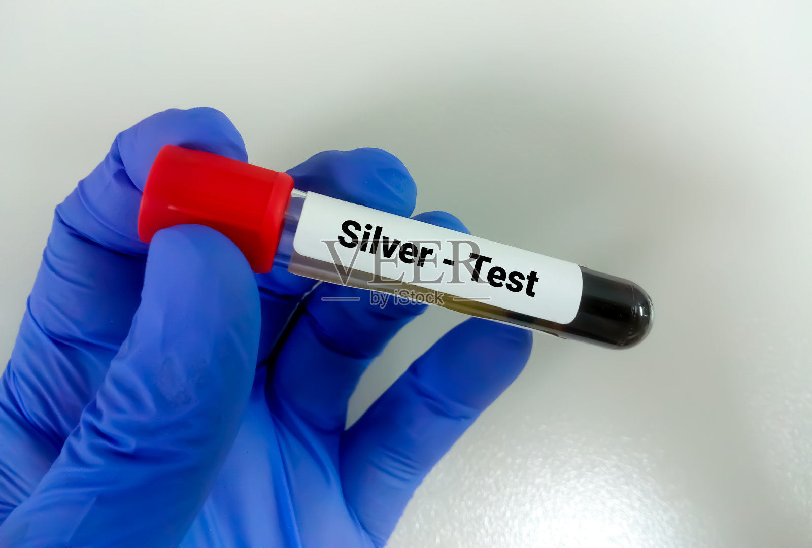 血液样本银(重金属)测试，有毒金属。银毒性诊断照片摄影图片