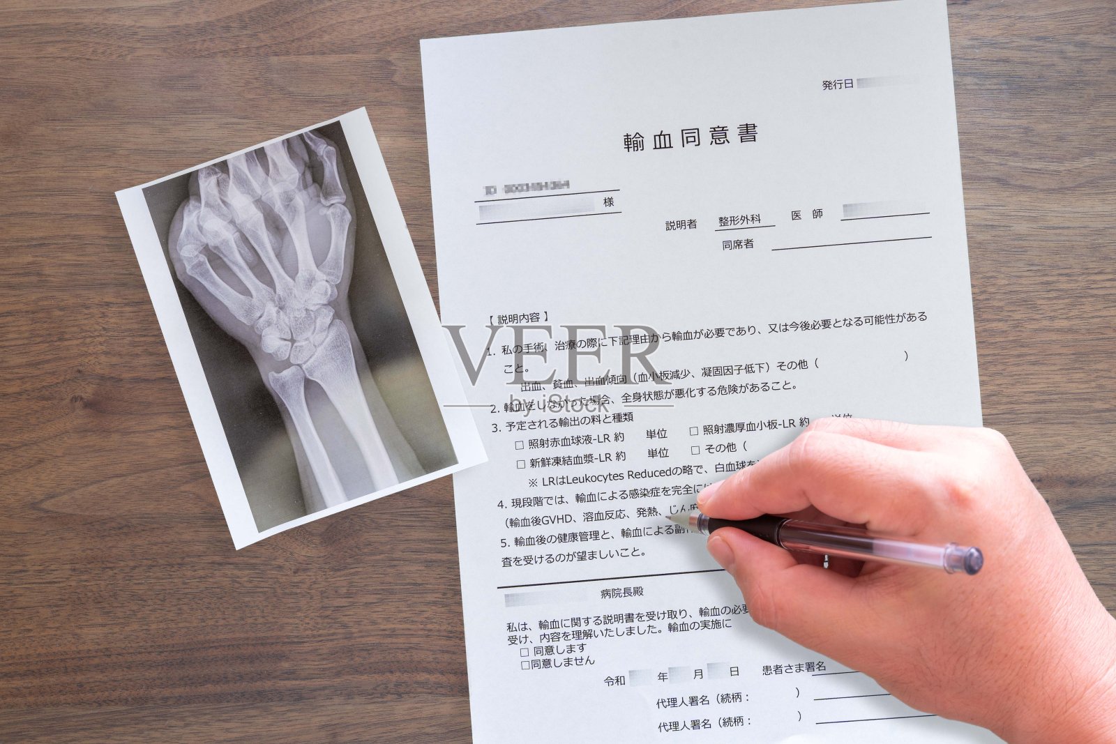 输液同意书，手(腕)照片摄影图片
