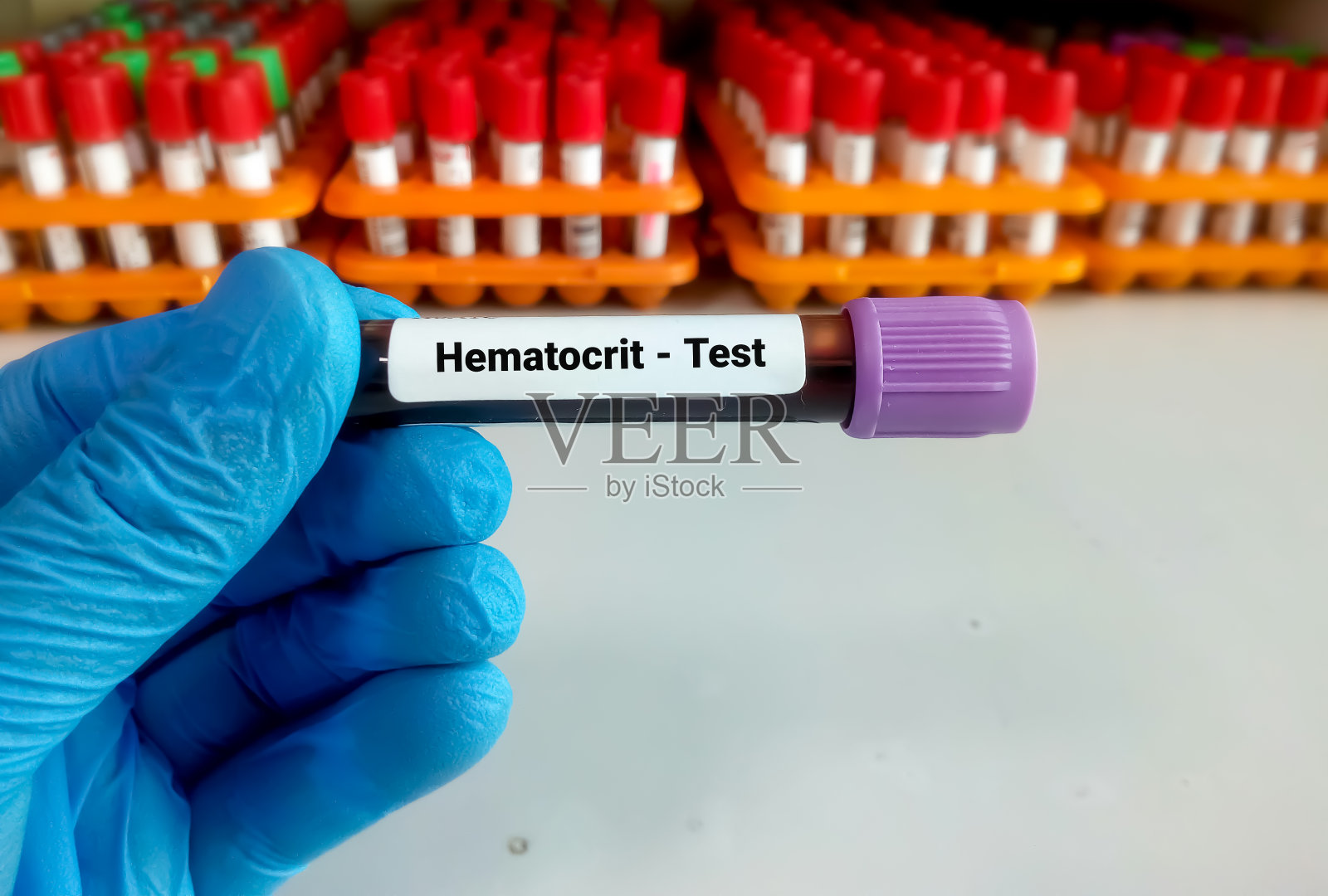 红细胞压积，红细胞压积，红细胞压积照片摄影图片