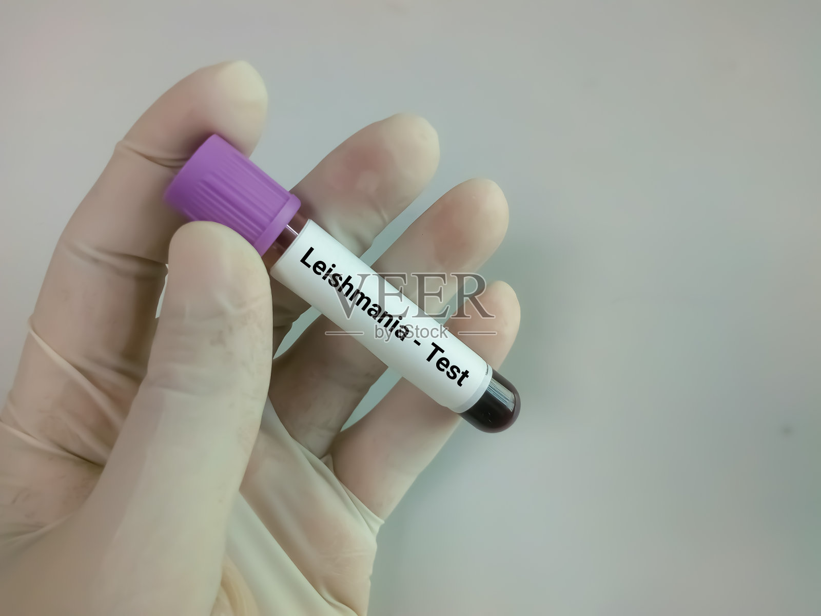 血液样本进行利什曼原虫检测，利什曼病照片摄影图片