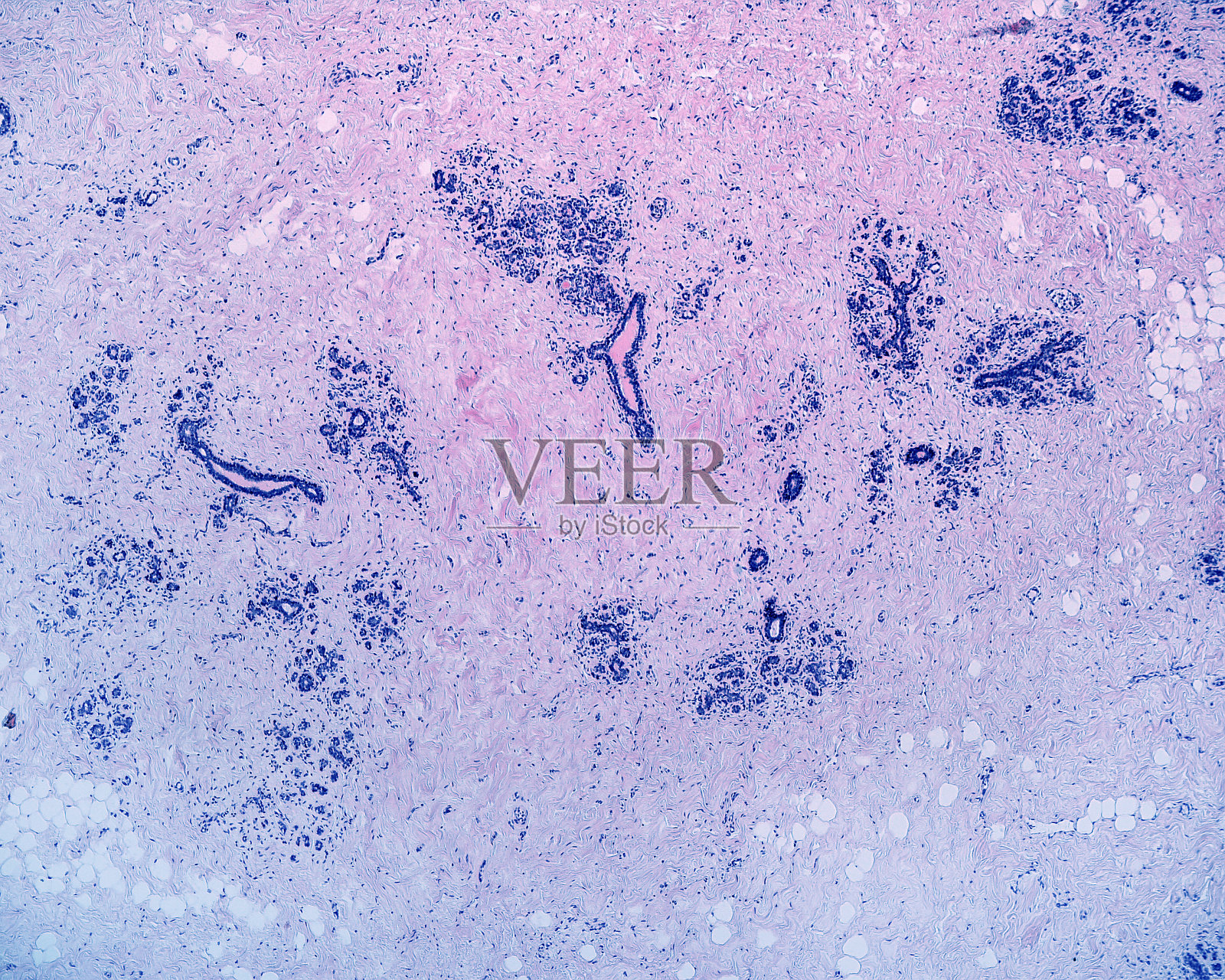 人类的乳房。腺病照片摄影图片