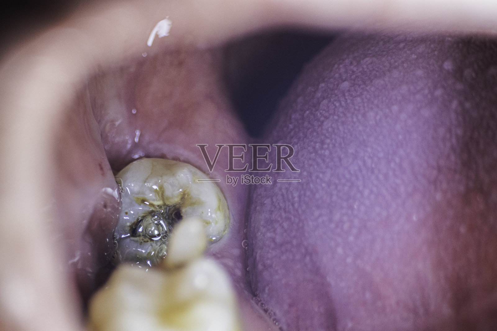 口腔和牙齿照片摄影图片