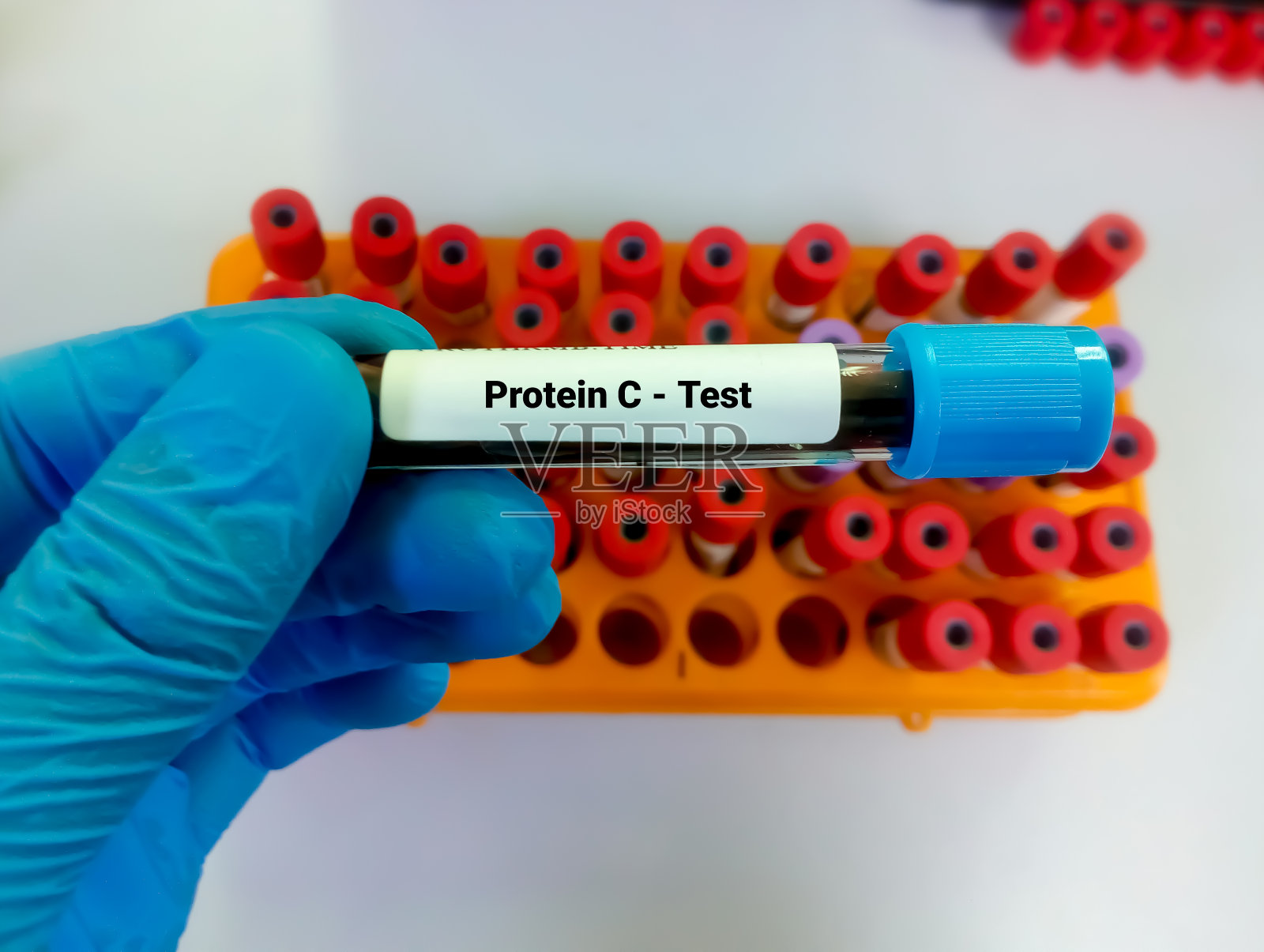 有实验室背景的血液样本用于C蛋白检测的试管。凝血障碍的诊断。肺栓塞。照片摄影图片