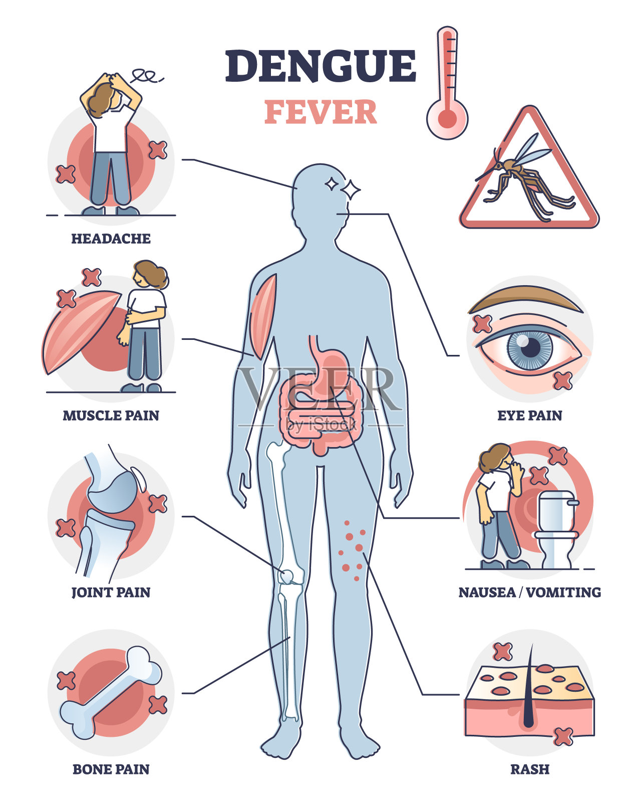 登革热症状宣传海报、教育媒介图解插画图片素材