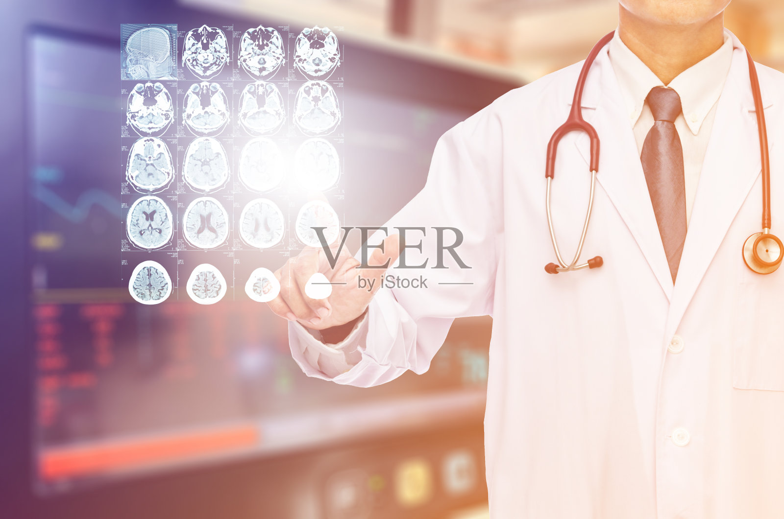 放射科医生触片脑部核磁共振照片摄影图片