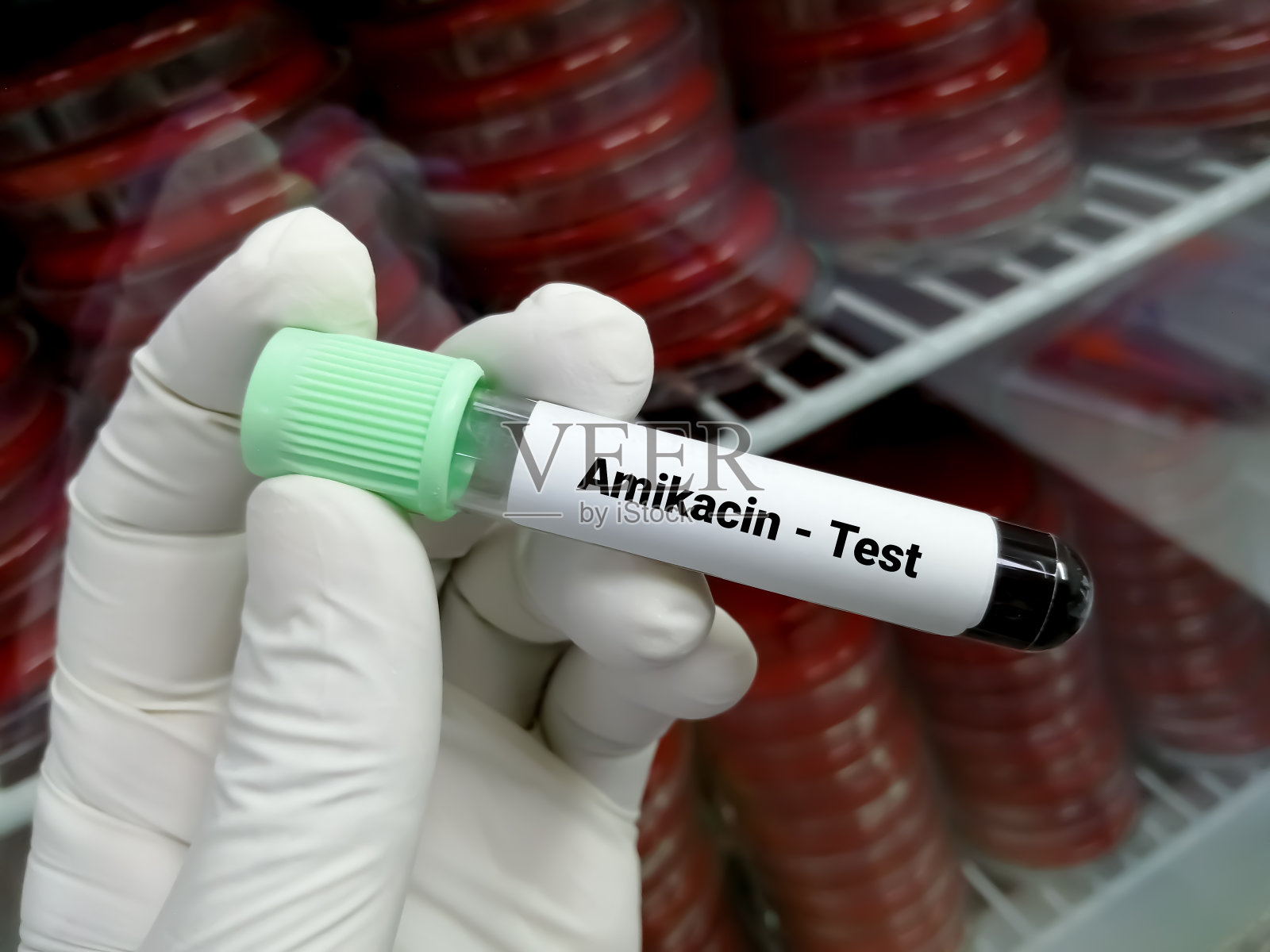 有实验室背景的手持式血液样本进行阿米卡星水平检测照片摄影图片