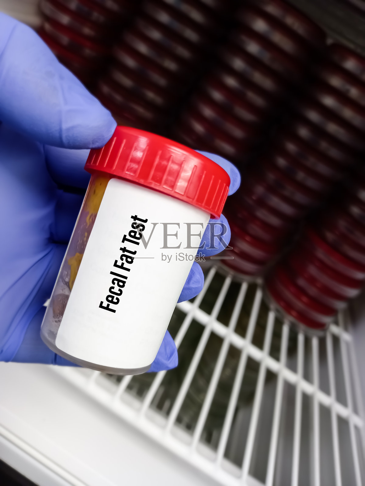 塑料容器内的粪便样本用于粪便脂肪测试，以诊断吸收不良的情况照片摄影图片