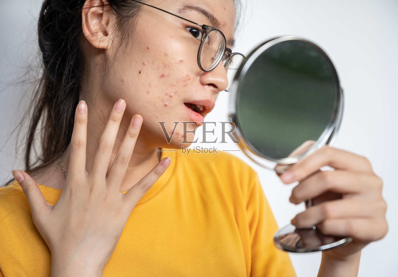 年轻的亚洲妇女感到震惊，而看着痤疮和疤痕出现在脸上的迷你镜子。照片摄影图片