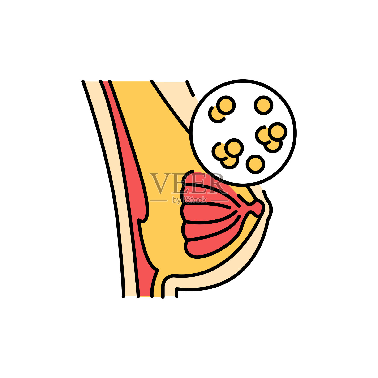 乳腺炎彩色线图标。人类疾病。插画图片素材