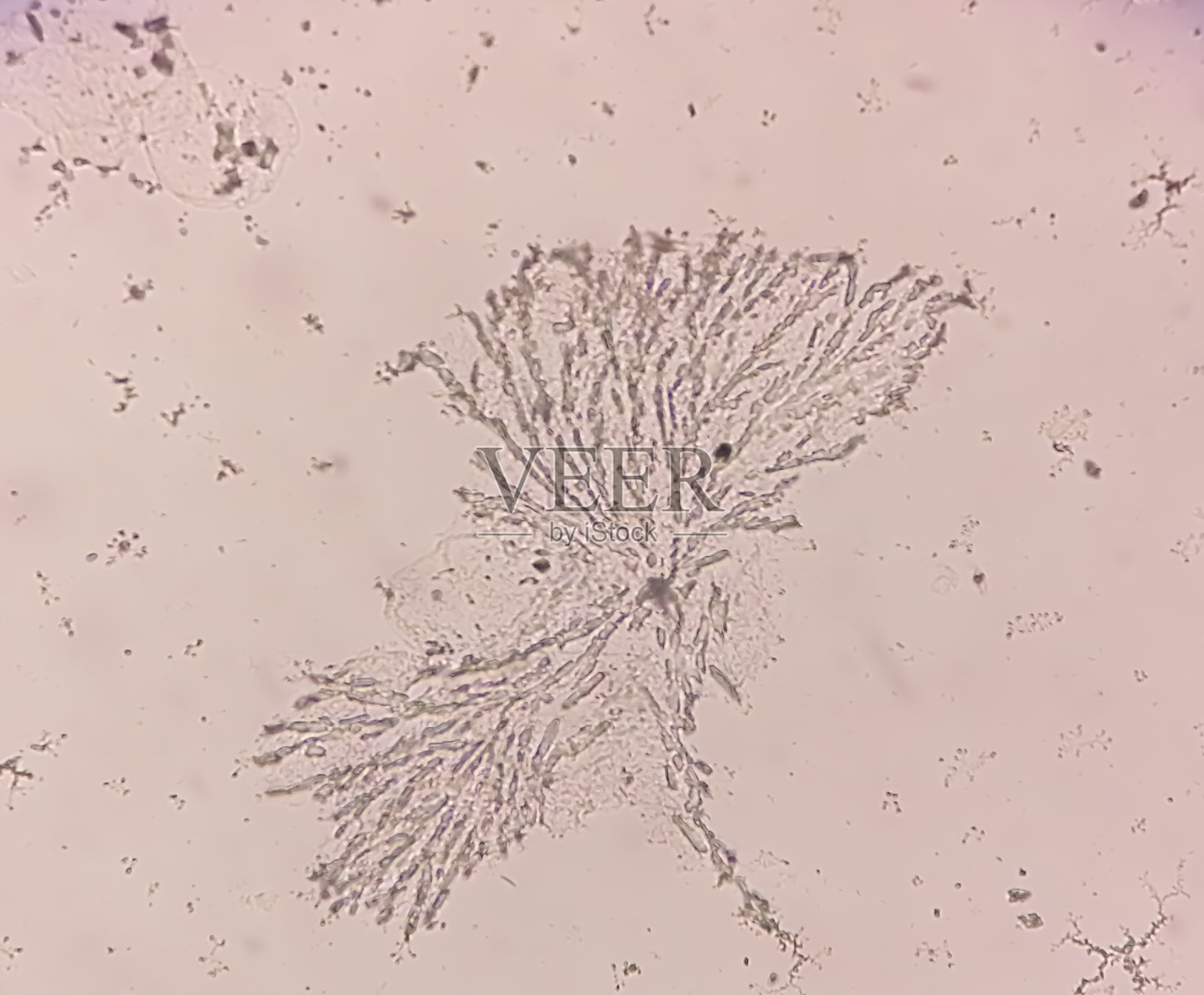 显微镜下的皮肤藻类。指甲刮真菌。100 x照片摄影图片