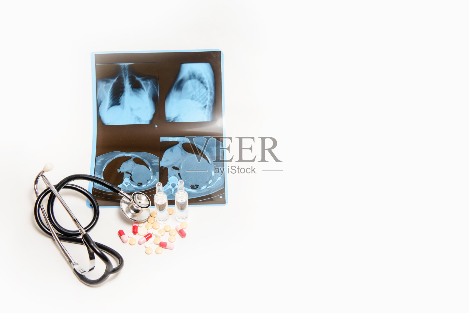 透明安瓿、小瓶、药丸近听诊器对冠状病毒肺炎胸部x线检查。照片摄影图片