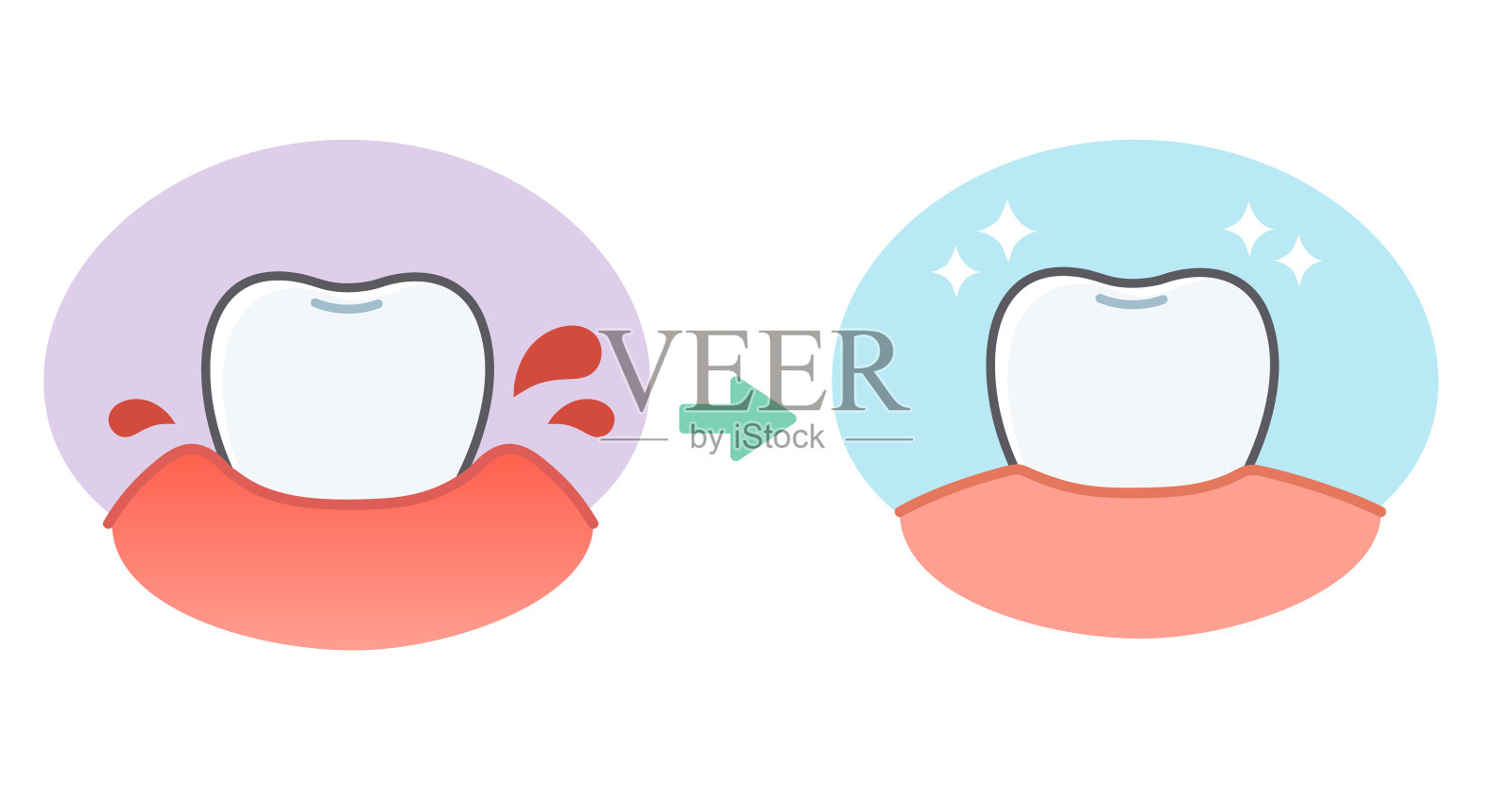 前牙龈炎前可爱插图插画图片素材