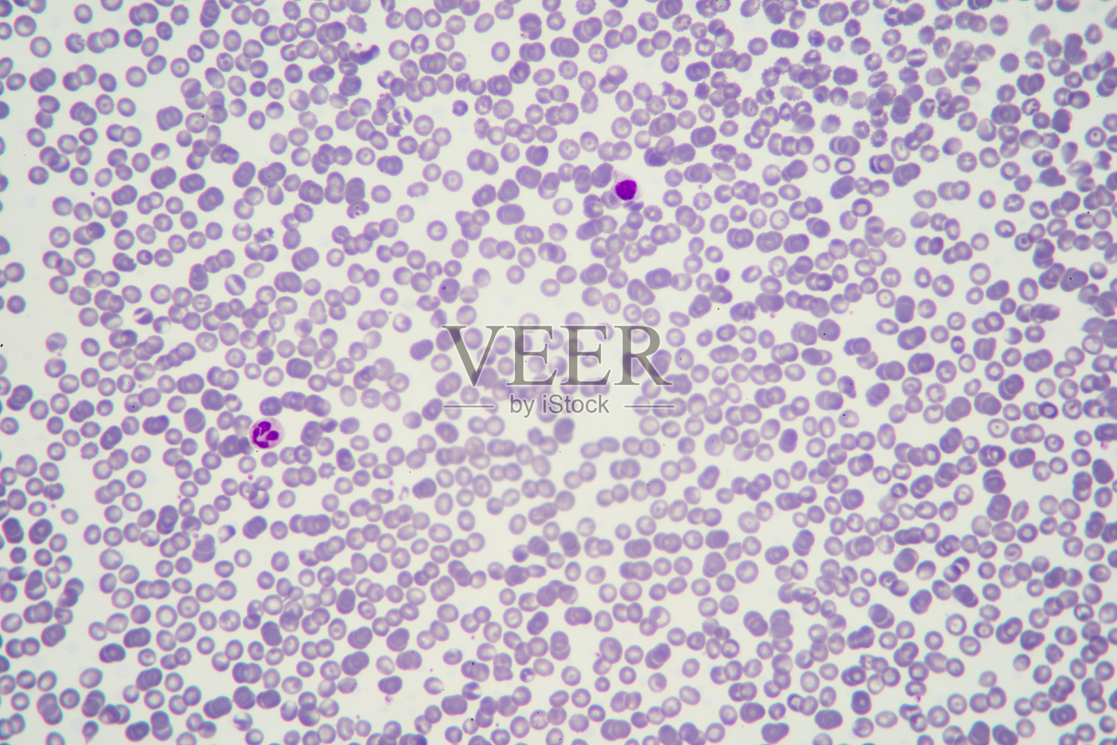 涂片上正常的红白血细胞，血液样本照片摄影图片