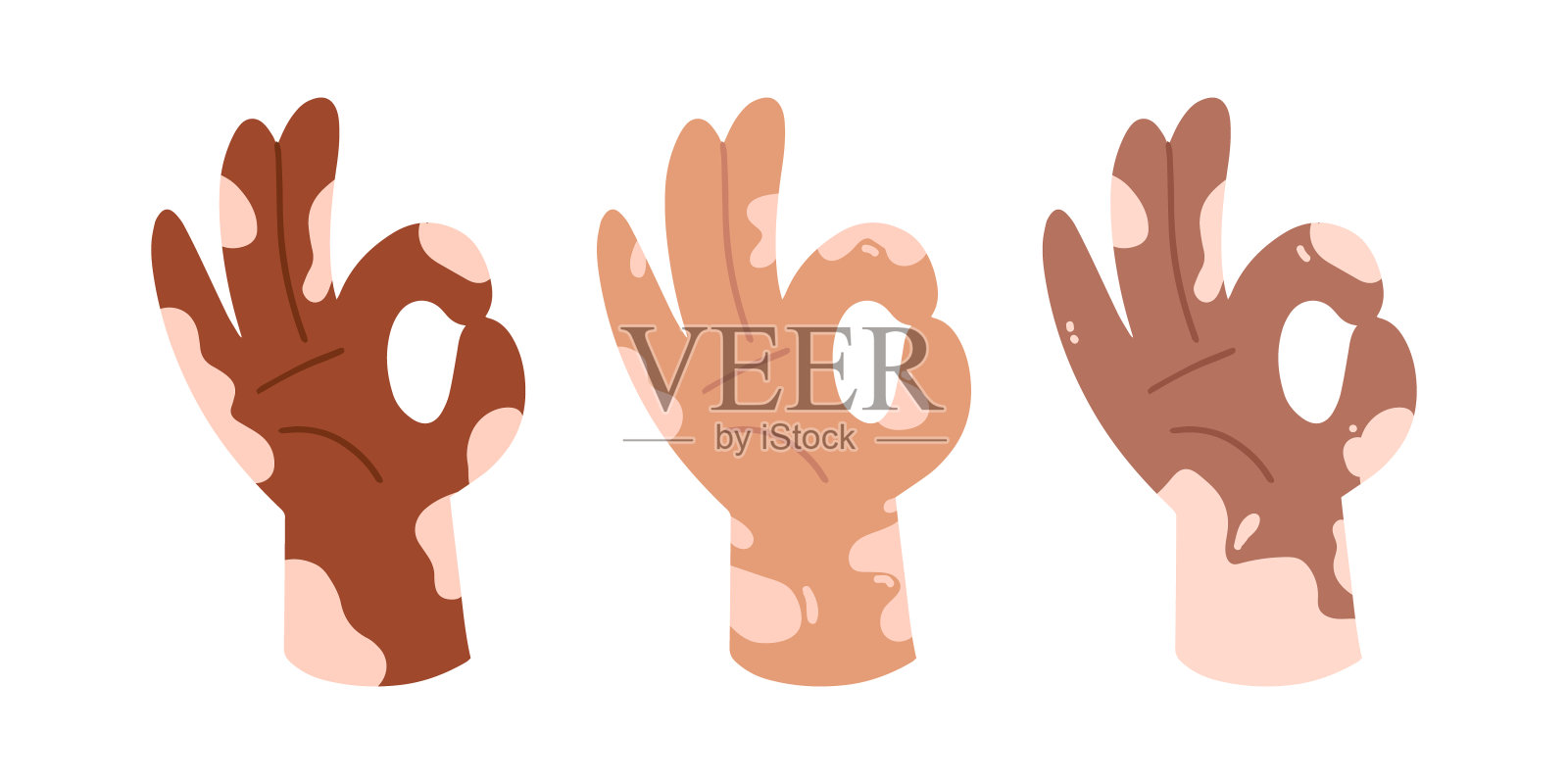 世界白癜风日设计理念。患有白癜风皮肤病的人。好的，手势。没关系。自我接纳，自爱的概念。海报、横幅、卡插画图片素材