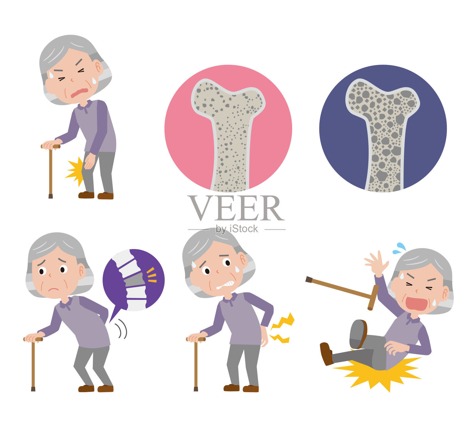 患有骨质疏松症的老年女性插画图片素材