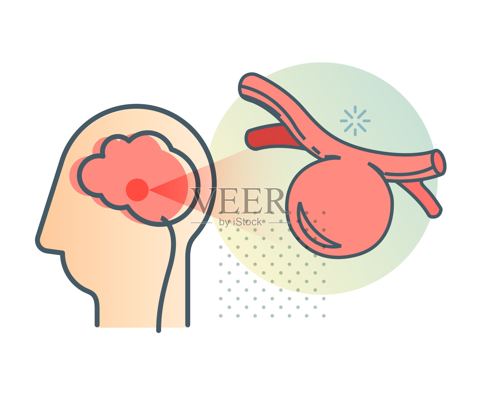 动脉瘤在一段时间内积聚-库存图标插画图片素材