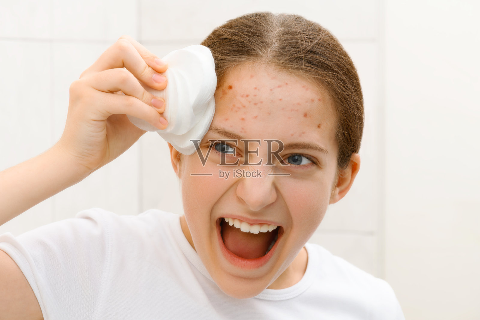 一个长粉刺，正在对着镜子大喊大叫的十几岁女孩的脸，她正在用化妆棉护理自己的皮肤，做一个非常情绪化的鬼脸照片摄影图片