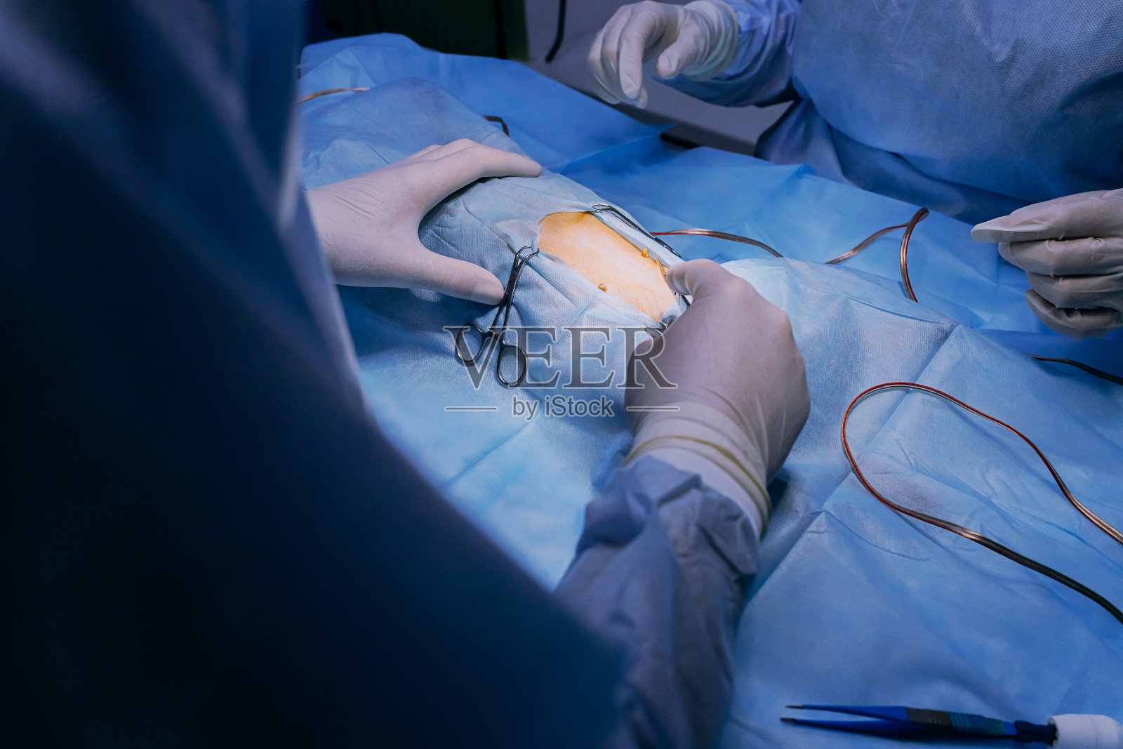 兽医医生在兽医诊所的手术室里为狗做手术。医药、宠物、动物、保健和人的概念。照片摄影图片