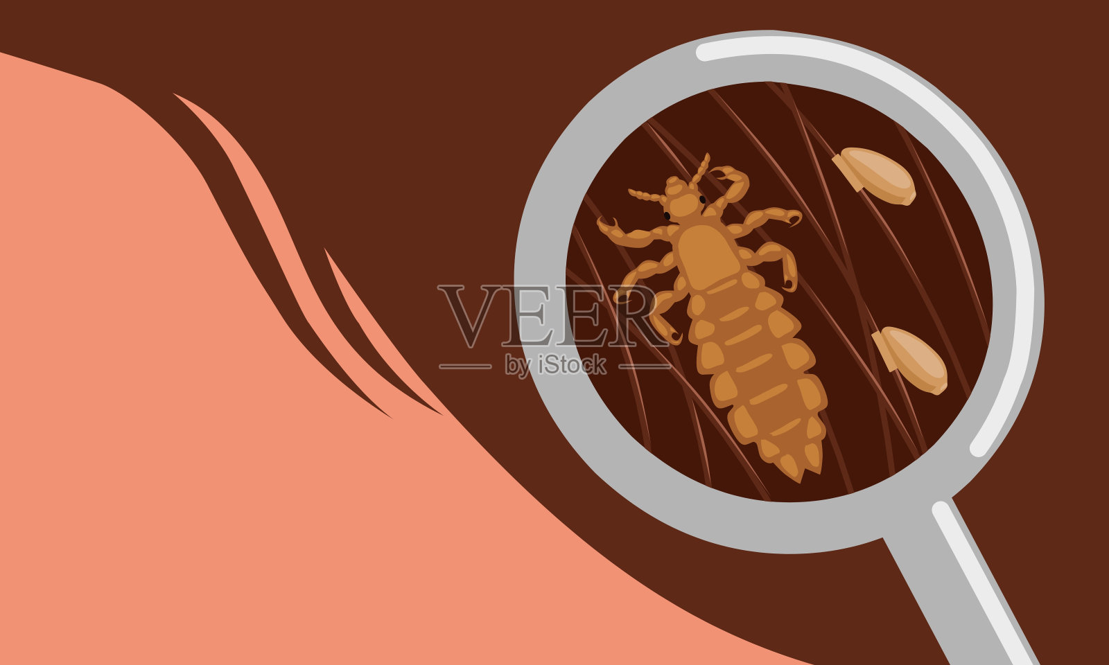 矢量图，头虱或头虱虫卵粘在头发上。插画图片素材