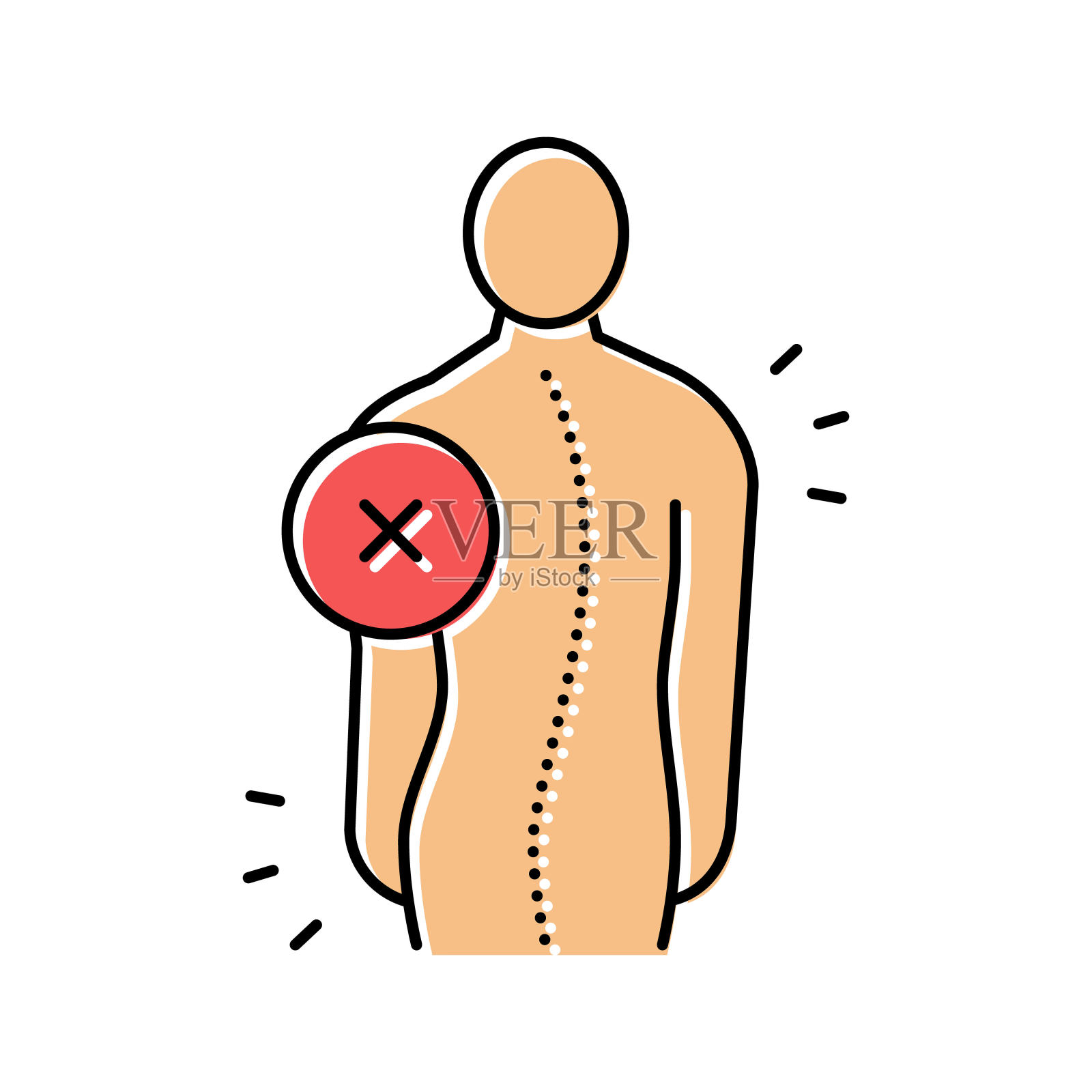 特发性脊柱侧凸彩色图标矢量插图插画图片素材