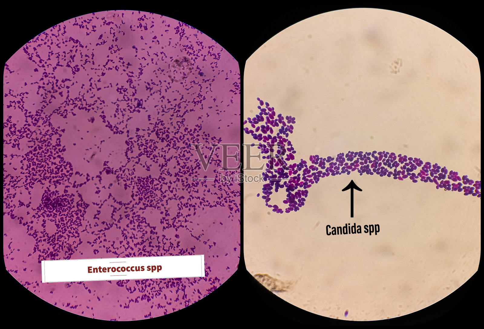 念珠菌属和肠球菌属，真菌，新兴多药真菌。白色念珠菌，酵母真菌。比较真菌和细菌细胞。照片摄影图片