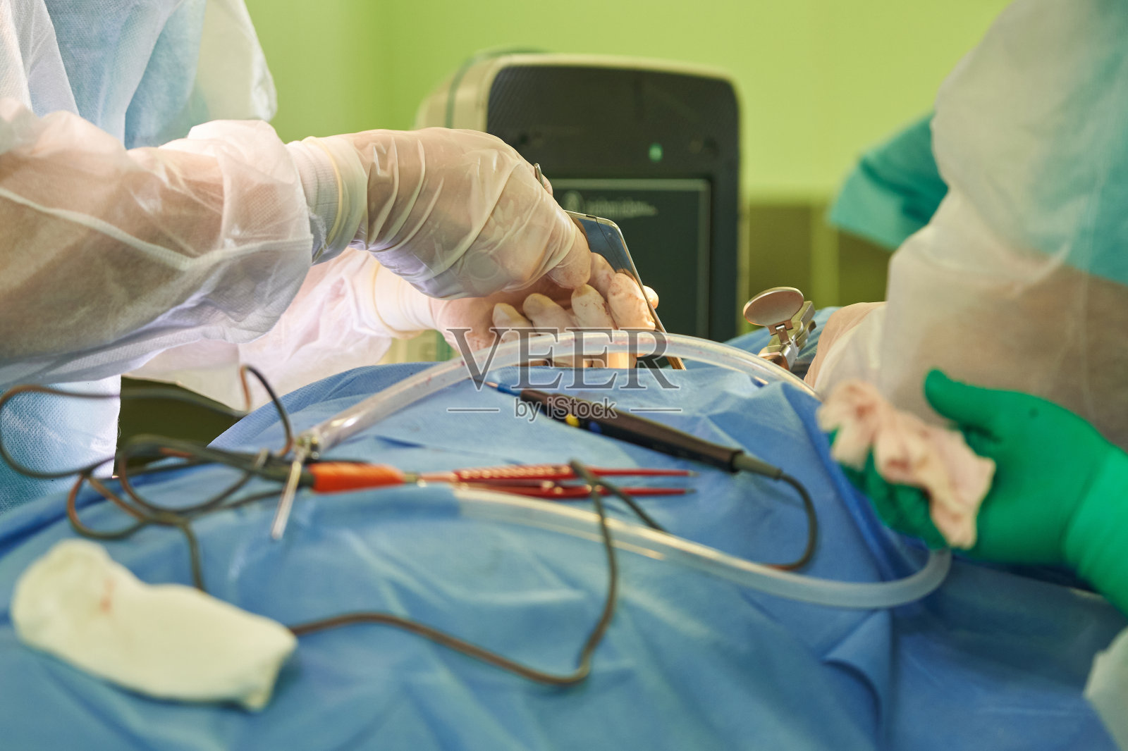 手术期间，医生的手在手术室里。特殊的手术设备。一个外科医生和一个戴手套的助手的手照片摄影图片