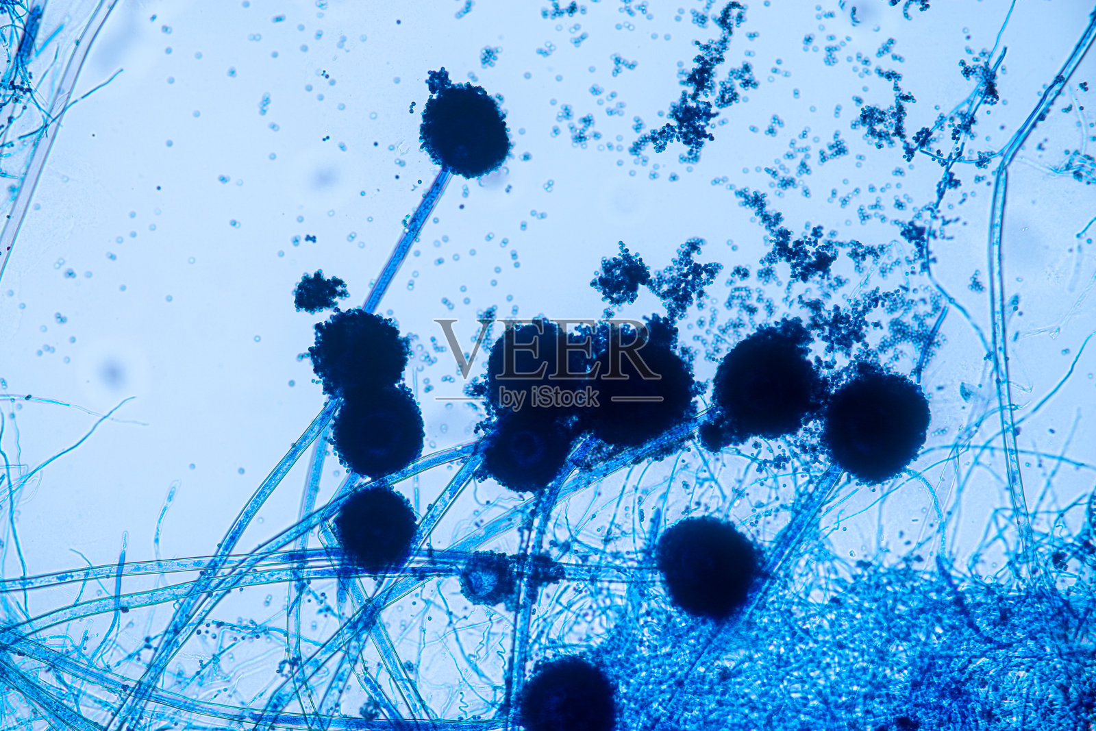 实验室微生物学显微镜下观察黑曲霉和米曲霉(霉菌)。照片摄影图片