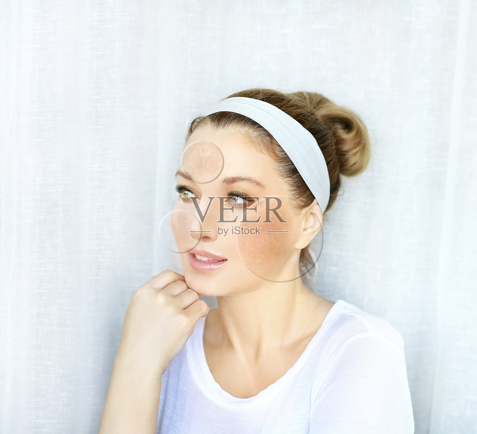 黑斑，雀斑，色素沉着(黄褐斑或黄褐斑)，概念-皮肤美白，皮肤美白，果酸，AHA，皮肤白皙。照片摄影图片