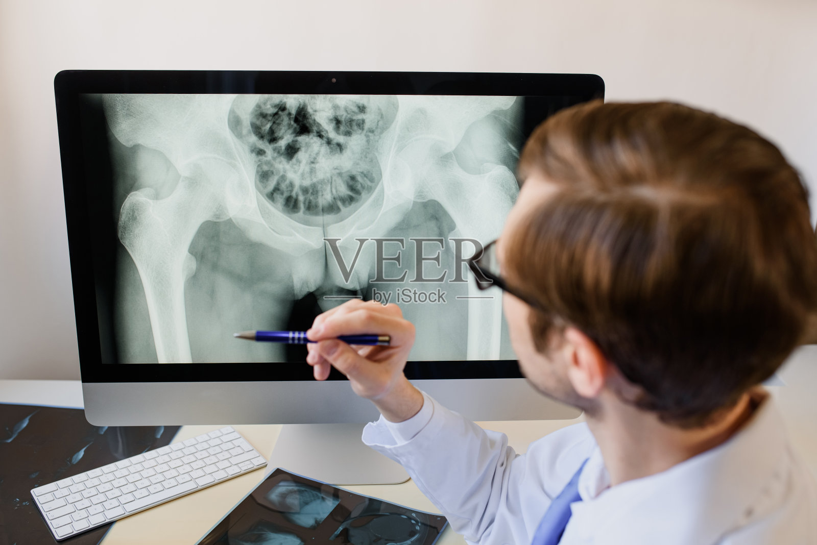 放射科医生在电脑上分析数字骨盆x光片。照片摄影图片