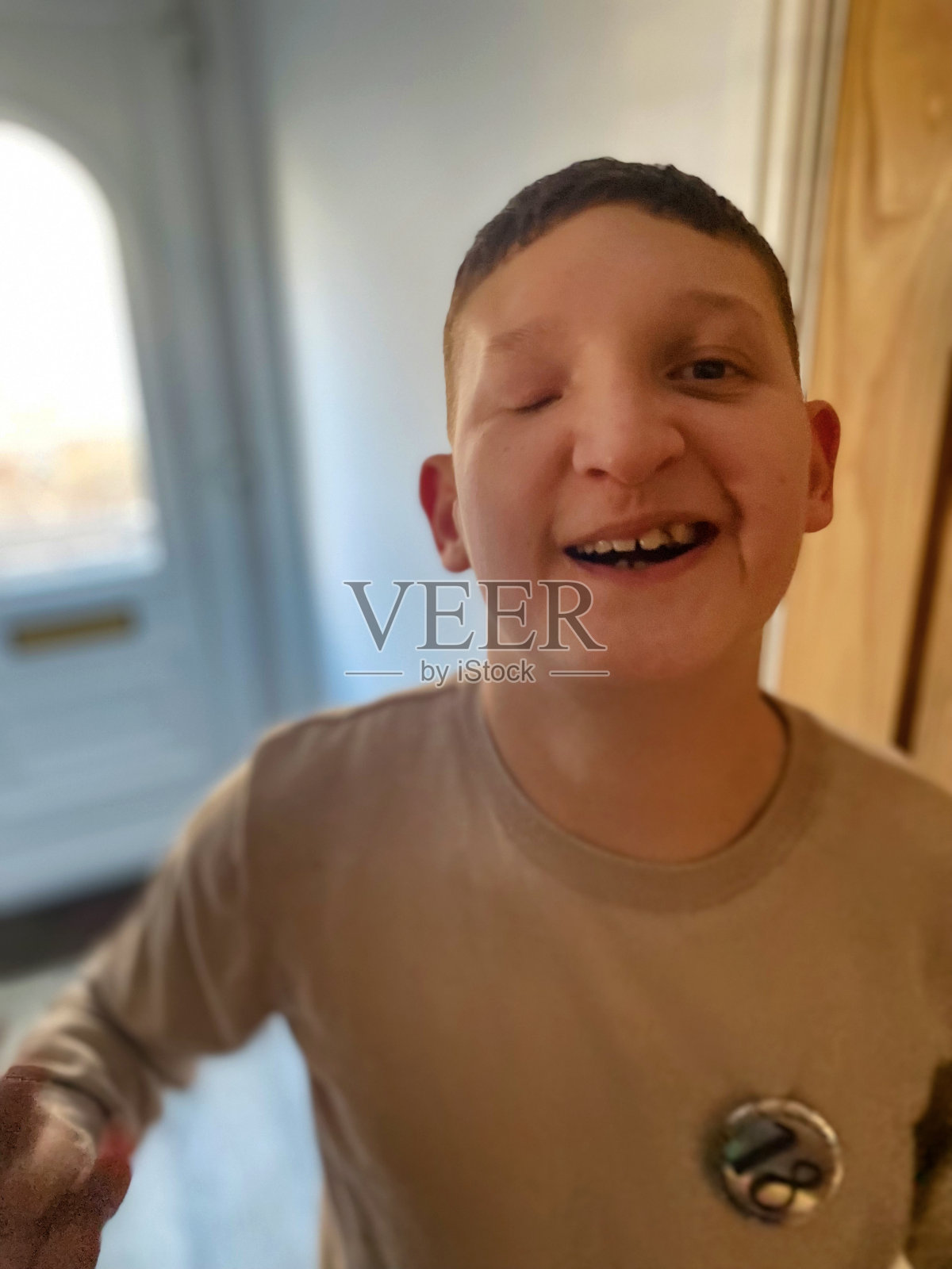 残疾的部分失明的男孩肖像照片摄影图片