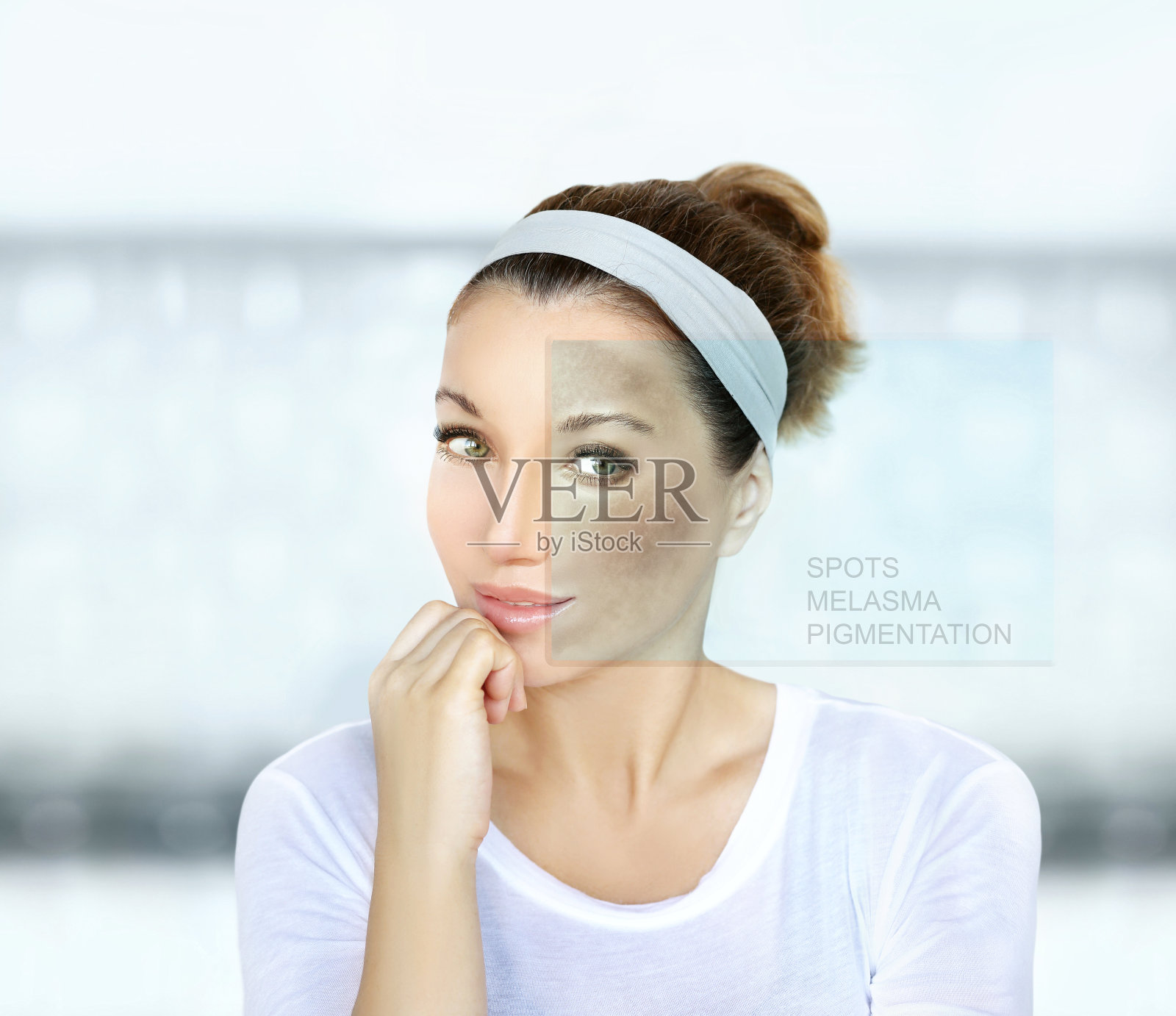 黑斑，雀斑，色素沉着(黄褐斑或黄褐斑)，概念-皮肤白化，皮肤白化，果酸，AHA，皮肤白化。照片摄影图片