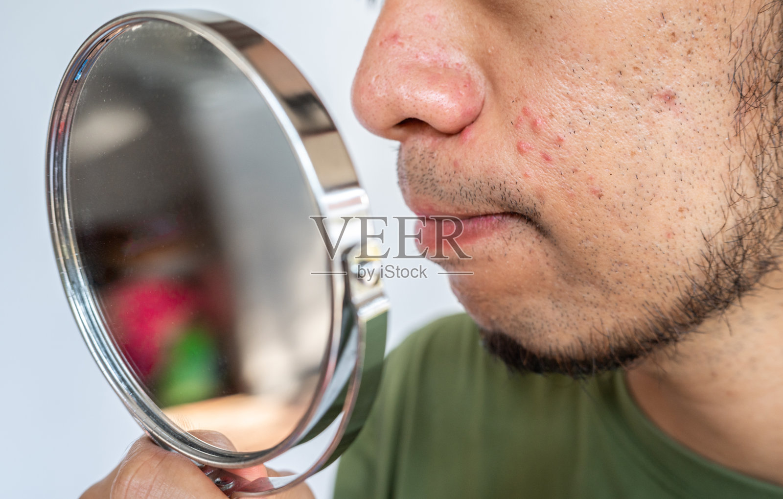 一名亚洲男子通过迷你镜子看到自己脸上的青春痘问题。照片摄影图片