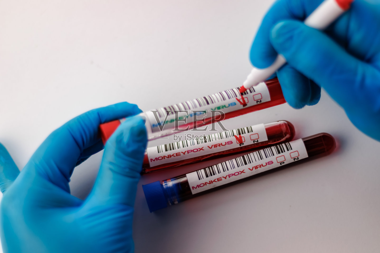 猴痘病毒阳性和阴性血液测试烧瓶照片摄影图片