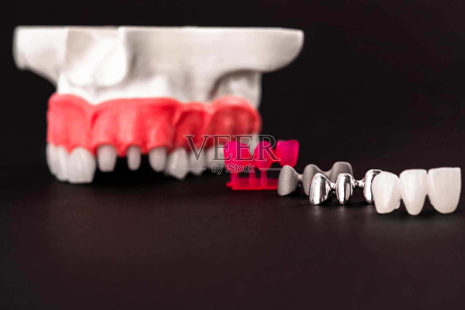 植牙和牙冠安装过程中零件隔离在黑色背景上。医学精准的3D模型。照片摄影图片