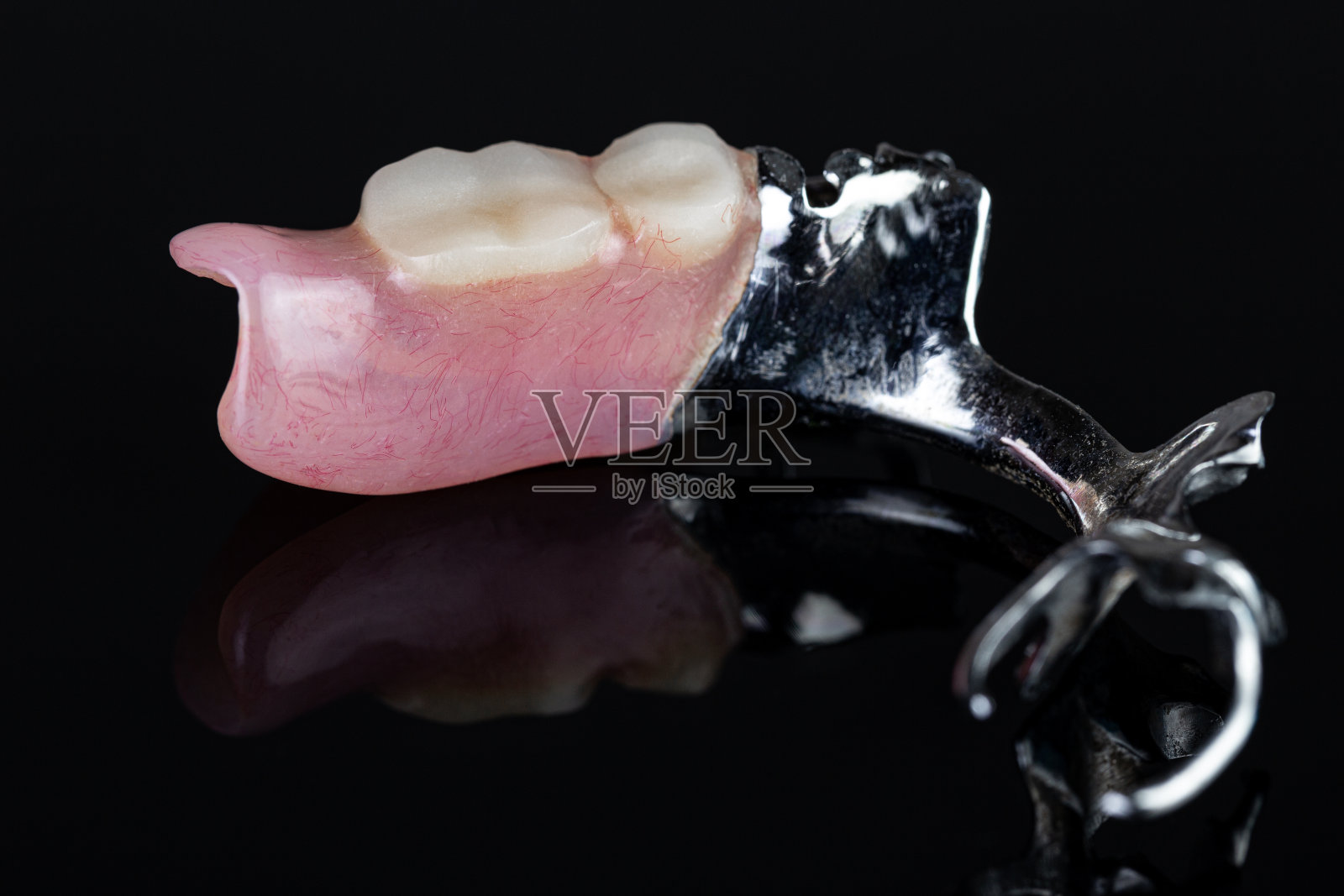 局部假牙照片摄影图片