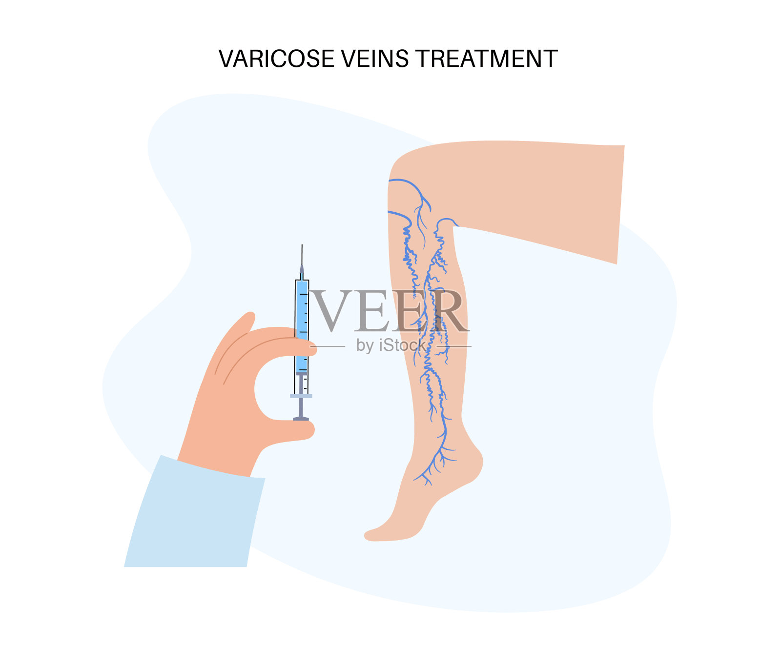 静脉曲张的注射过程插画图片素材