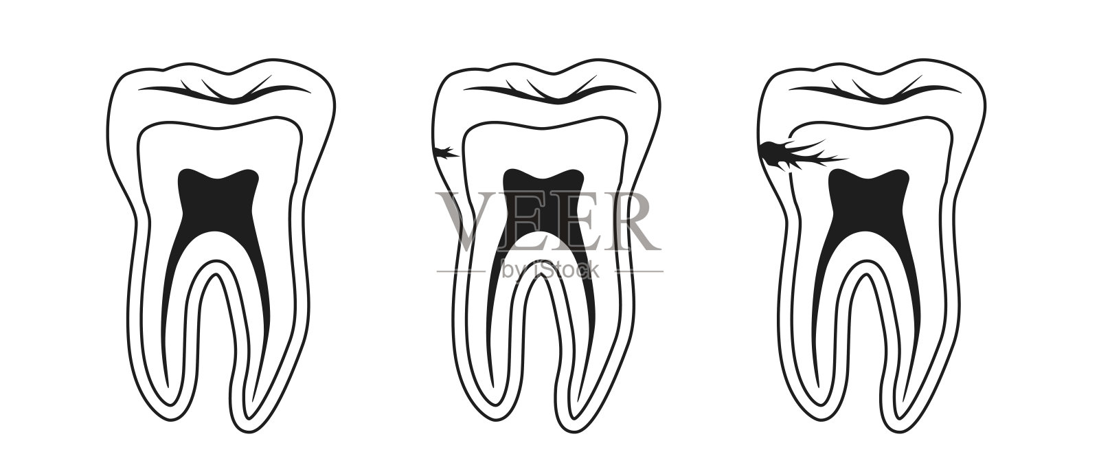 牙齿轮廓与龋齿矢量图标插画图片素材